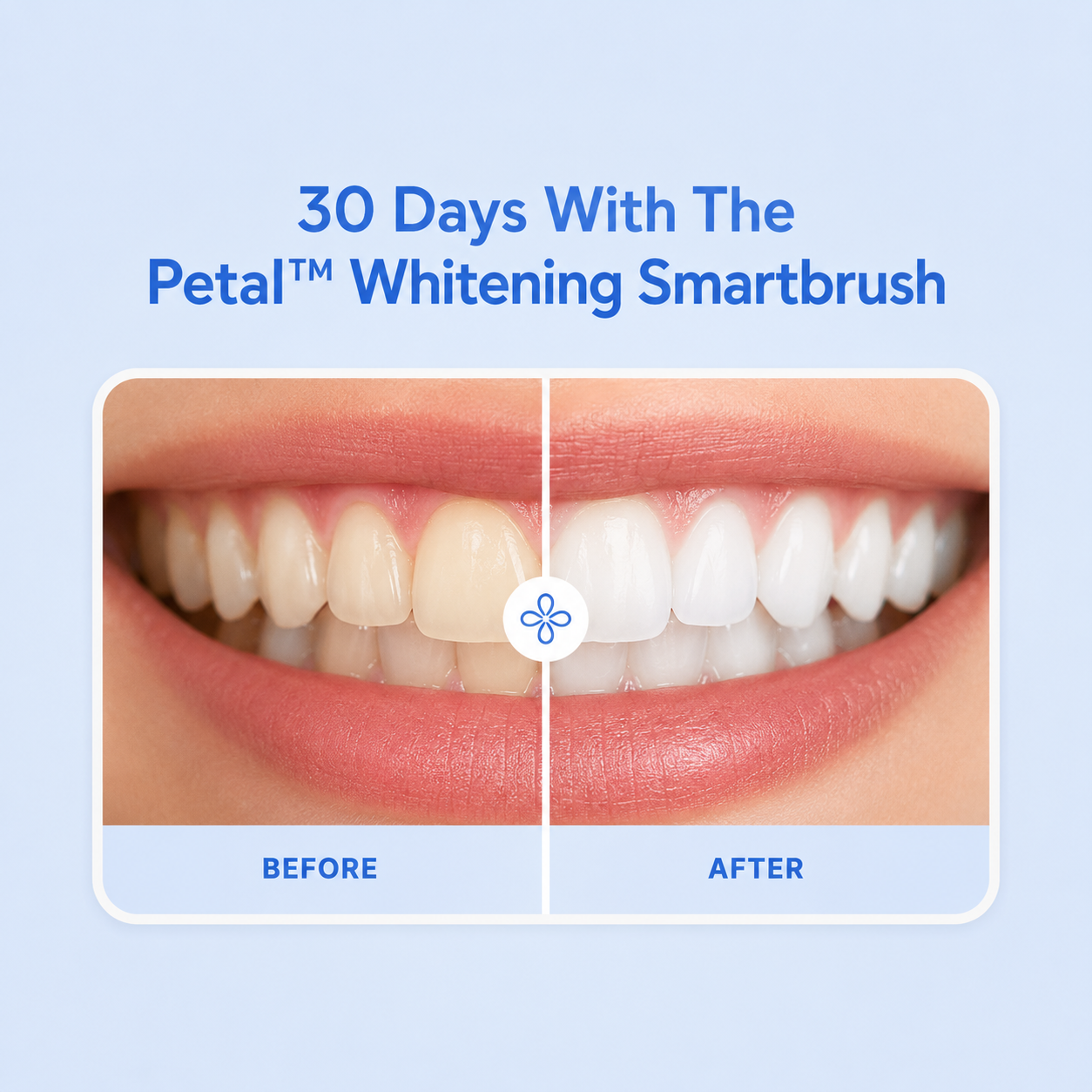 Petal U-Shaped Whitening Toothbrush