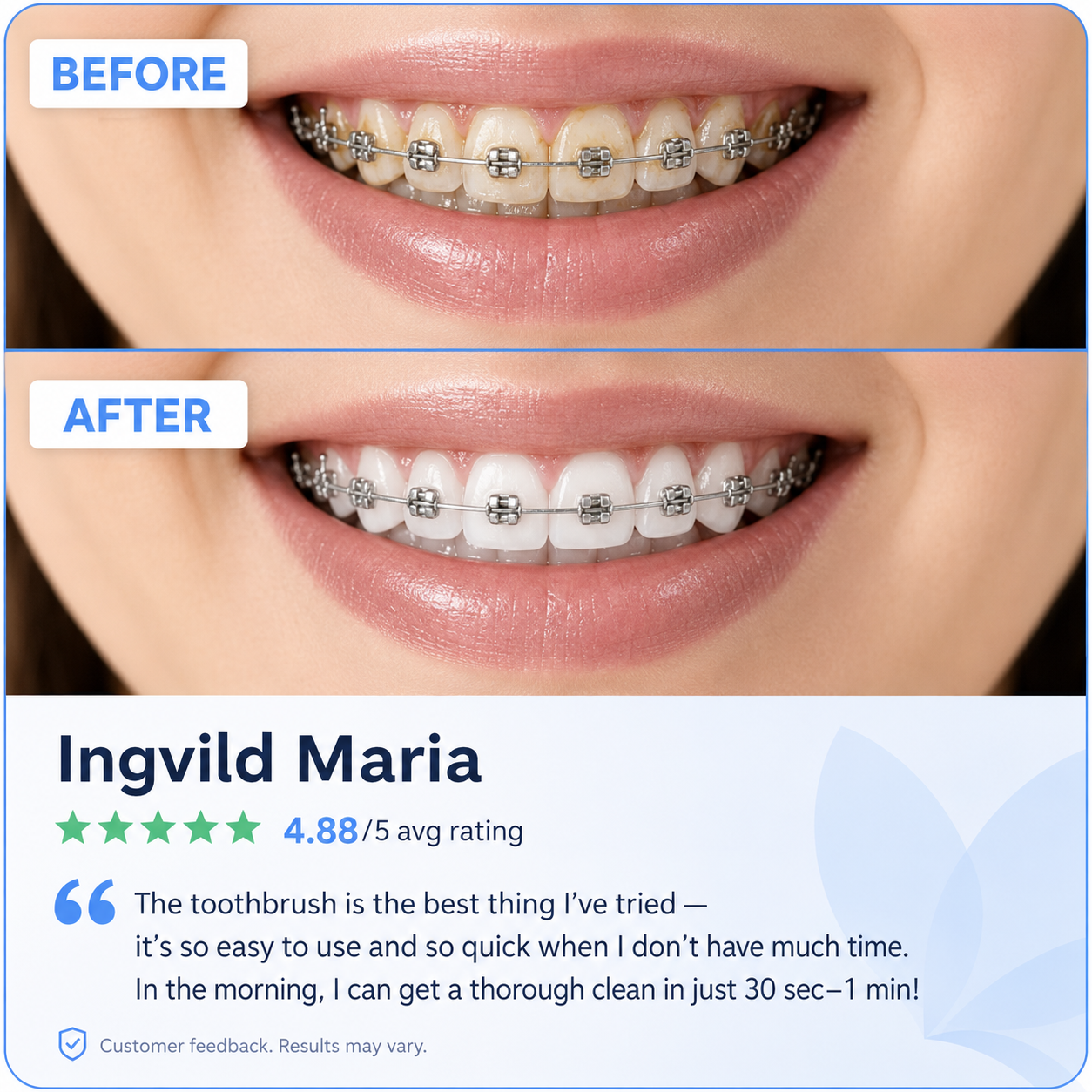 Petal U-Shaped Whitening Toothbrush